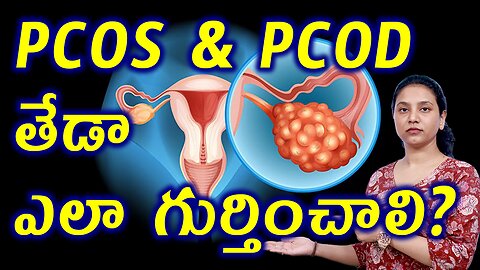 PCOS & PCOD తేడా ఎలా గుర్తించాలి? Main Differences Between PCOS and PCOD Homeopathy Treatment Cure