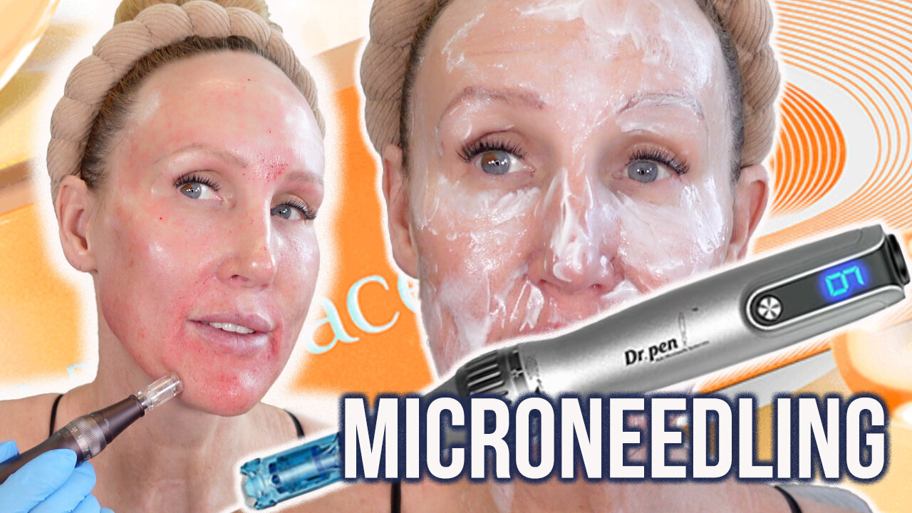 Microneedling at Home // Beginner Friendly Tutorial