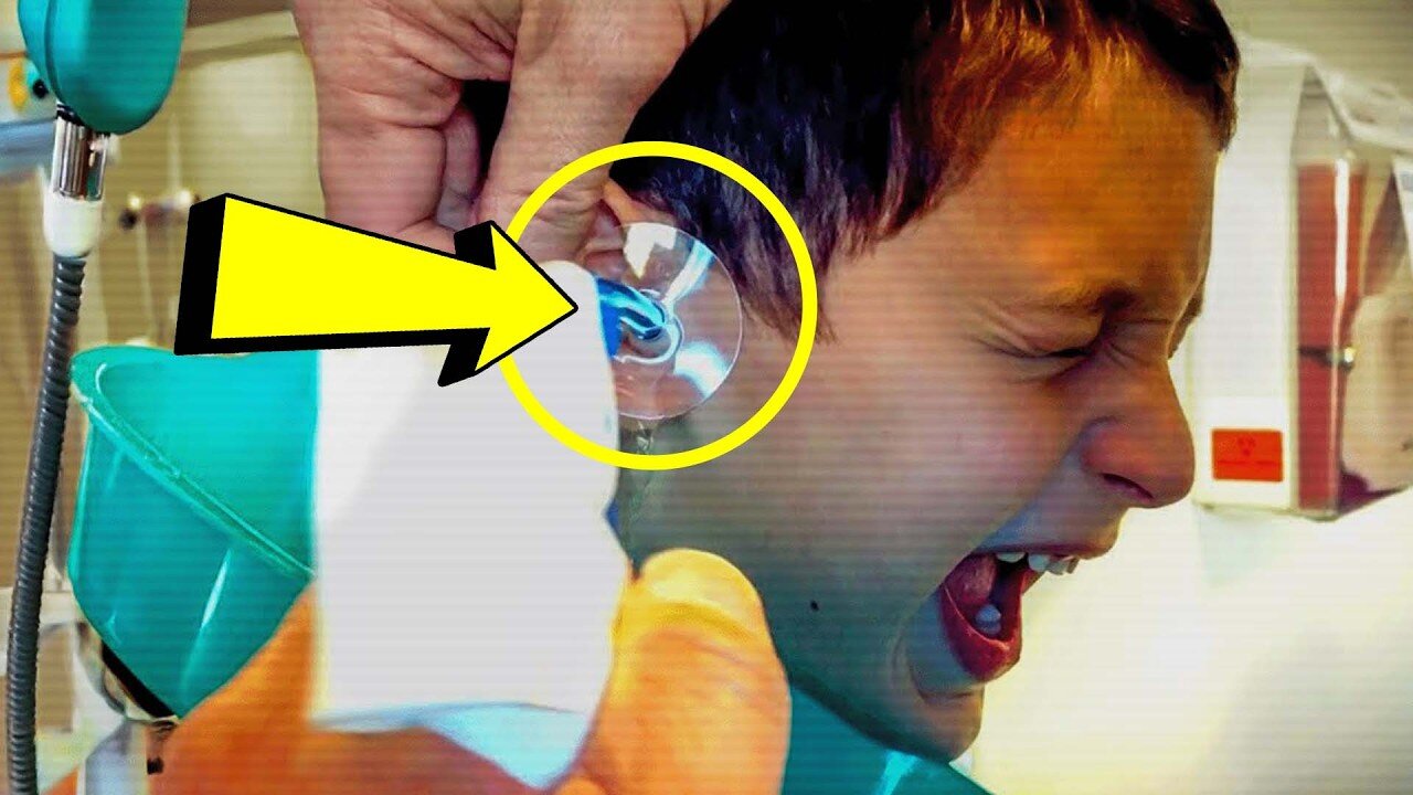 Boy Complains of Headache — What Doctors Pull From His Nose Leaves Everyone Horrified