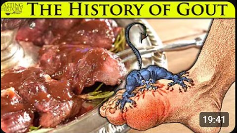 🍗 Gout: The Price of Eating Like a King 👑 | The Royal Disease Explained Through Food