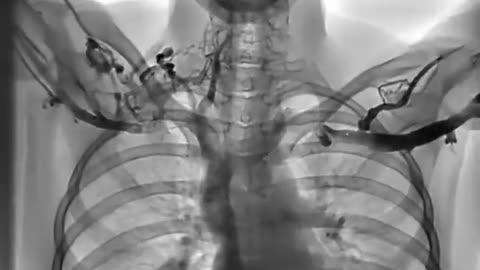 How different arm positions influence blood flow back to the heart