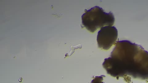 Amoeba