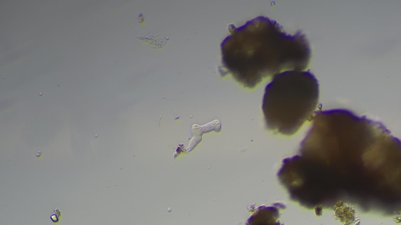 Amoeba