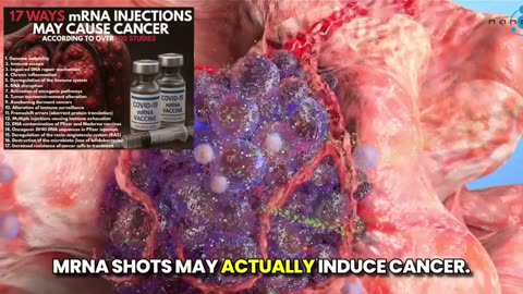 Mass mRNA "Vaccination" Caused a Turbo Cancer Epidemic