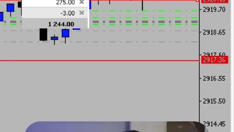 Forex trading #forex #trading #forextradingforbeginners #forextrading