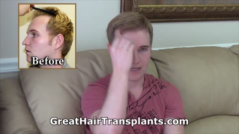 Dr. Brett Bolton Restores a Young Man’s Confidence with a Life-Changing Hair Transplant