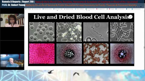 Dr. Robert Young on Clots in Vaccinated Blood