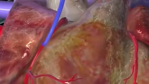 Coronary Artery Bypass Graft Surgery (Open Heart Surgery)