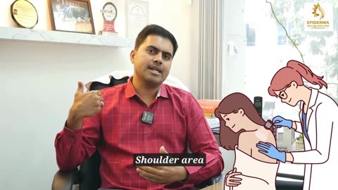 Acne Treatment in Jayanagar -Dr. K C Dharam Kumar - Dermatologist in Bangalore