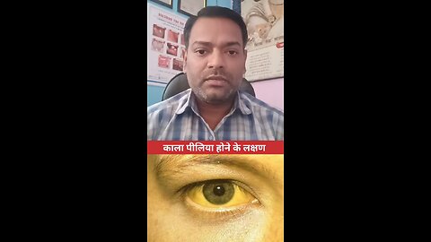 काला पीलिया के लक्षण ।
