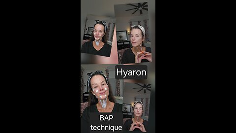 Hyaron BAP technique face and neck, hydration plus wrinkle reduction