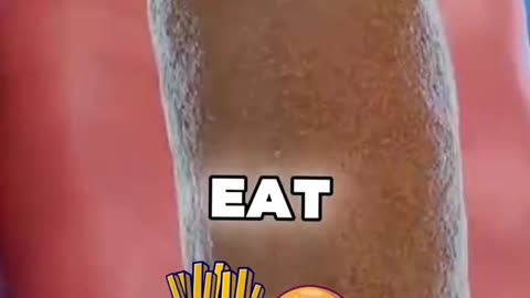 Remove Constipation in 15 Minutes