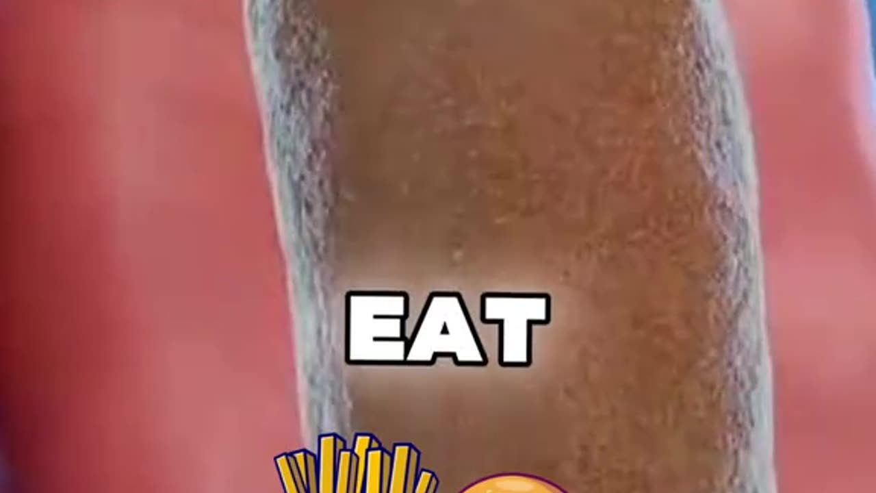 Remove Constipation in 15 Minutes