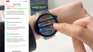 New Precise Blood Lipids Uric Acid Smart Watch ECG+PPG Clock Bluetooth Call Health Care