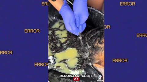 The wig saved her life