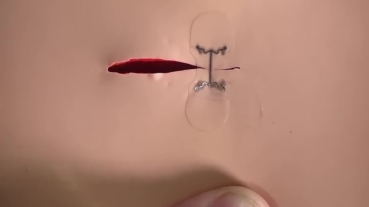 New Way to STITCH