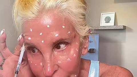Miracle X Mesotherapy Demo
