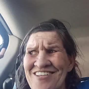 American Beauty Wants a Date with Elon Musk – Those Teeth Could Cut Barbed Wire! 😂