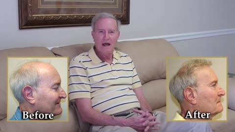 Dr. Brett Bolton Hair Transplant Surgery