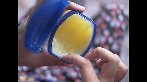 Never Put Vaseline Anywhere On Your Skin