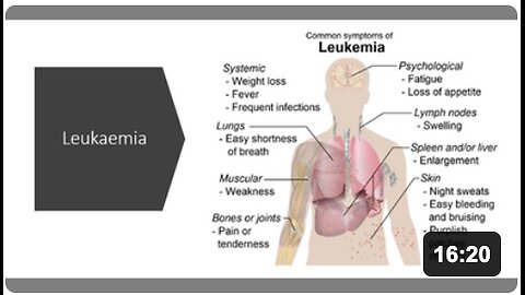 Leukaemia (Blood Cancer) Natural Treatment