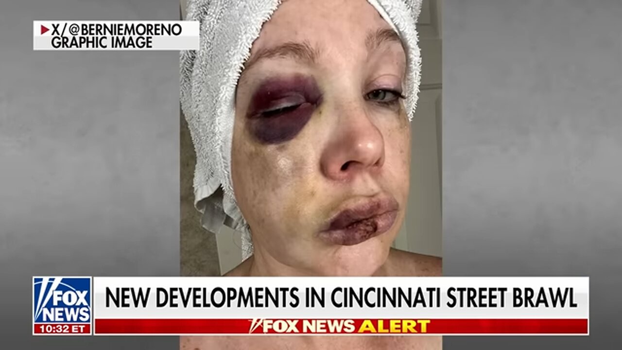 JUST IN: Cincinnati street assault suspect released on bond