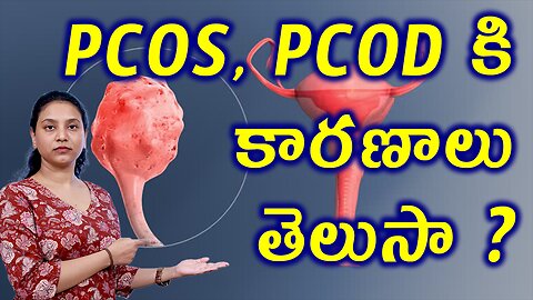 PCOS PCOD కి కారణాలు తెలుసా? Main Causes For PCOS and PCOD Trusted Homeopathy Treatment Cure Clinic