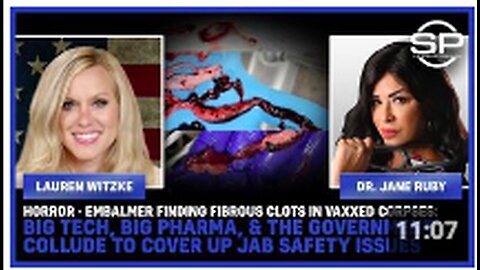 "Embalmer Discovers Fibrous Clots in Vaccinated Corpses: A Horror Story"