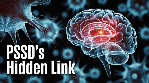 🧠 PSSD: The Hidden Neuroimmune Link Revealed 🔬 🧪 🔍