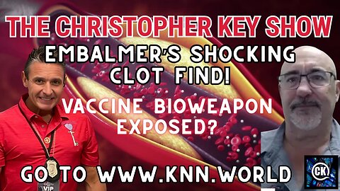 Embalmer’s Shocking Discovery: Richard Hirschman Exposes White Fibrous Clots