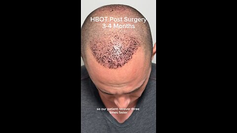 Grafts growth with HBOT!