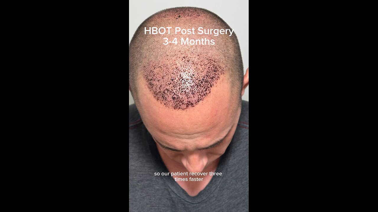Grafts growth with HBOT!