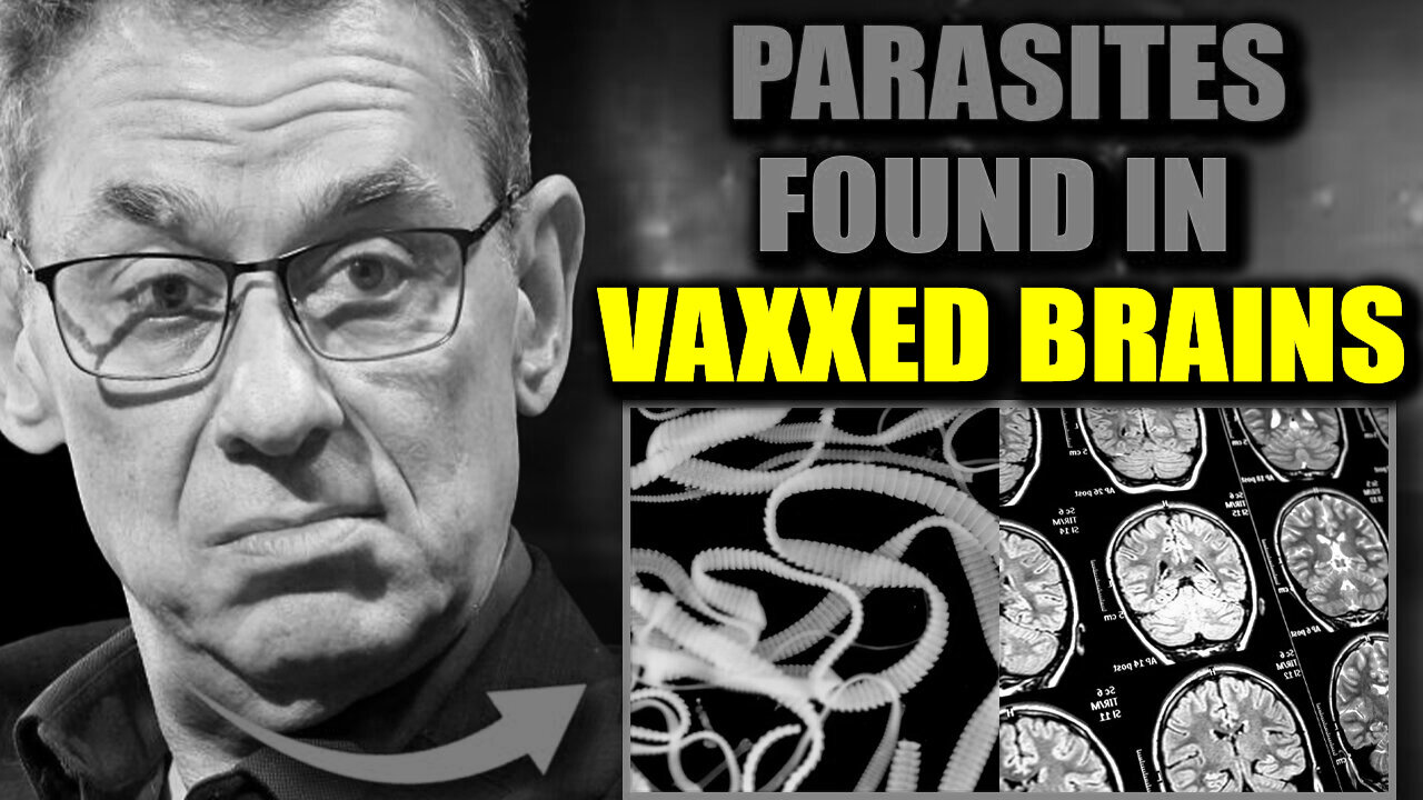 Scientists Discover "Parasitic Entities" in Brains of Jabbed - Media Blackout