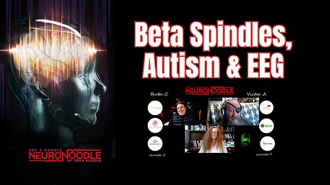 🎙️ Neurofeedback Side Effects, Beta Spindles & Autism EEGs | NeuroNoodle Neurofeedback Podcast