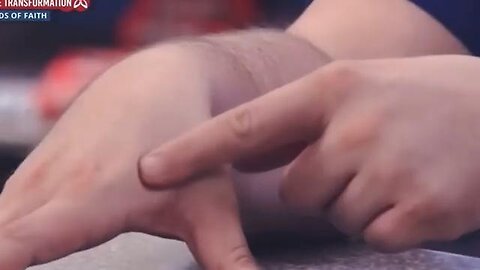 THEY CAN SEE IT, WHY CAN’T YOU? 💉💉💉#important #prophecy