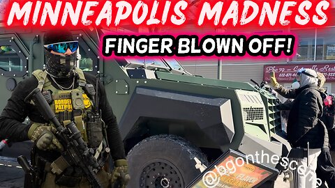 🔴 Minneapolis Turns WARZONE: Woman BLOWS UP Hand, ICE Agents Attacked, Local Police Abandon City