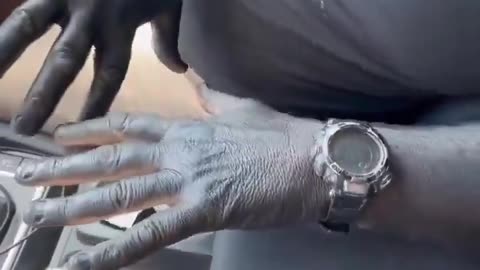 Man rubs squid ink on himself and finds out