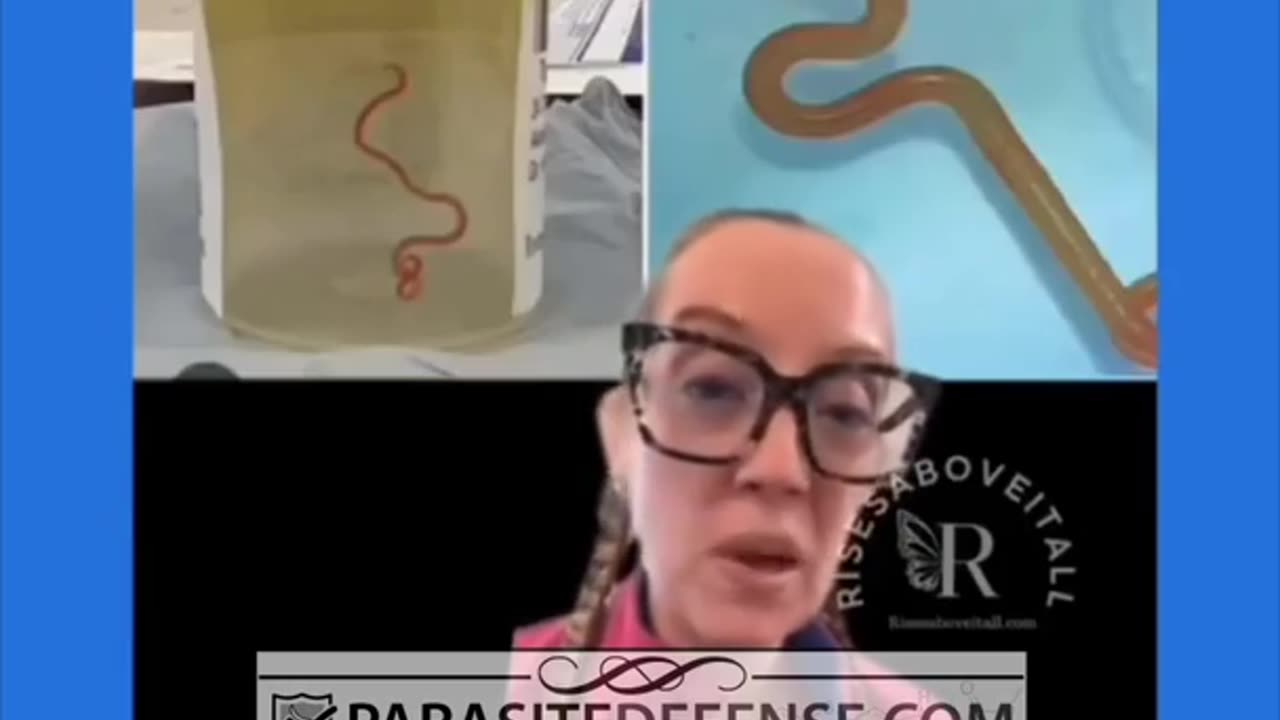 Exactly how rat lung worms can infest YOUR brain