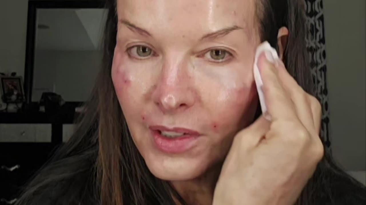 Miracle H or L PCL Procedure