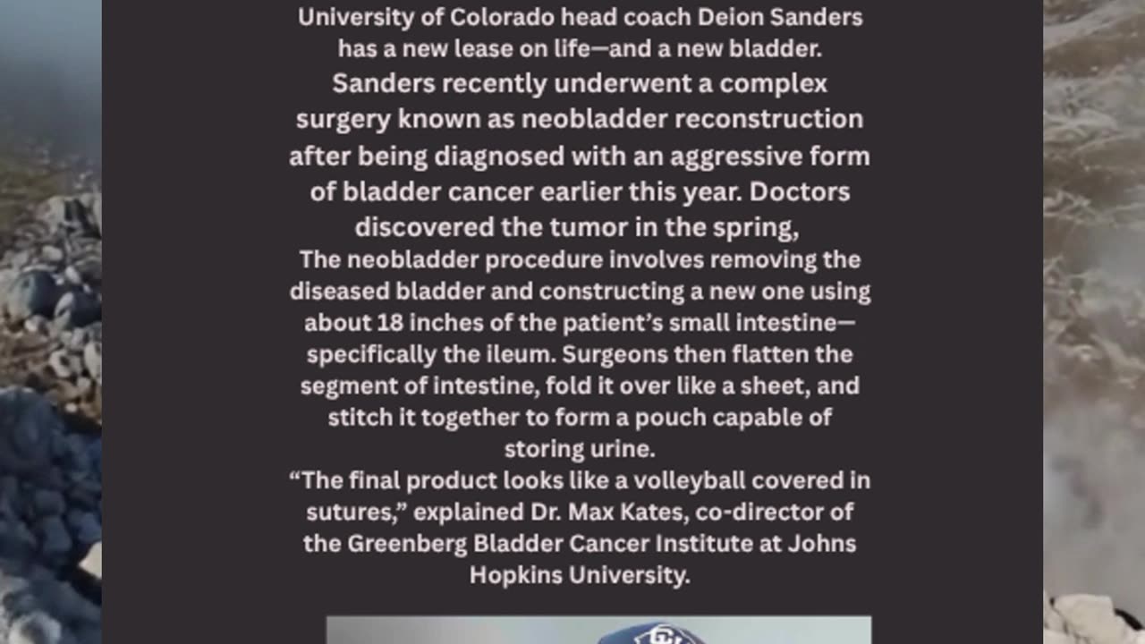 🏈 Deion Sanders Undergoes Life-Saving Bladder Surgery Coach Prime's New Battle Off the Field #news