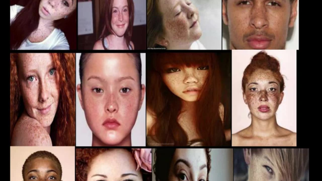 Freckles are brown skin pigment showing its dominance.