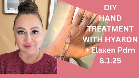DIY HAND TREATMENT WITH HYARON AND ELAXEN PDRN. 8.1.25