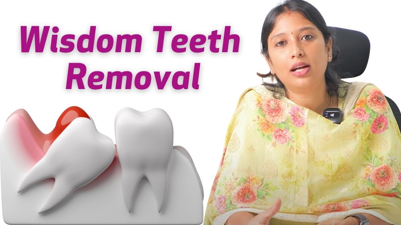 Wisdom Teeth Removal