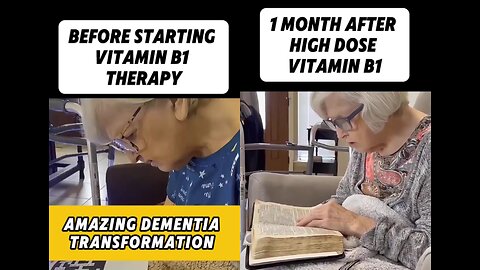 Amazing Dementia Transformation | Vitamin B1 | Benfotiamine