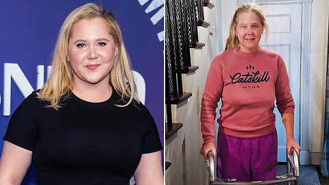 After undergoing spinal surgery, Amy Schumer shared an update with fans on her recovery.