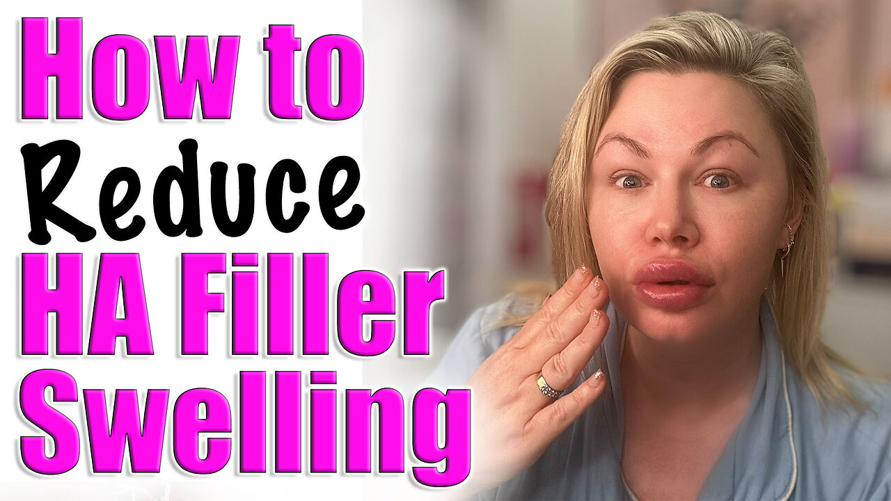 How to Reduce HA Filler Swelling! Code Jessica10 saves you Money, Wannabe Beauty Guru