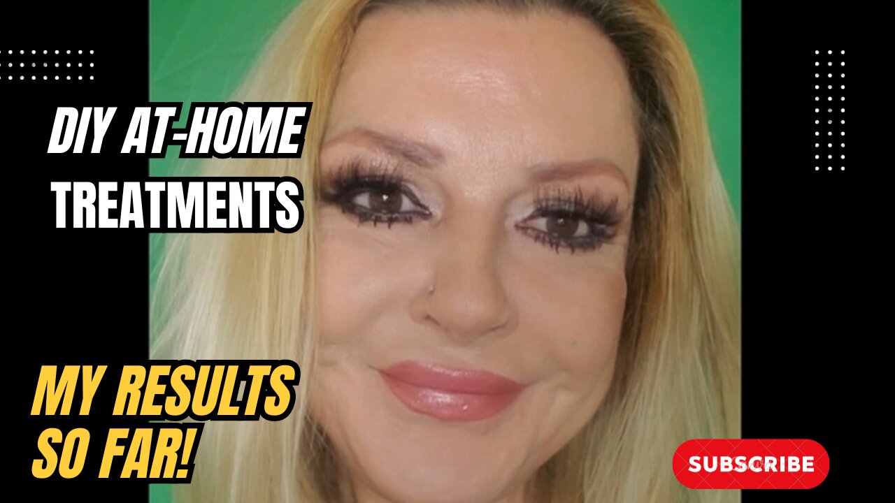 AN UPDATE ON MY DIY TREATMENT RESULTS SO FAR!