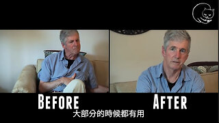 醫藥大麻對帕金森氏症效用