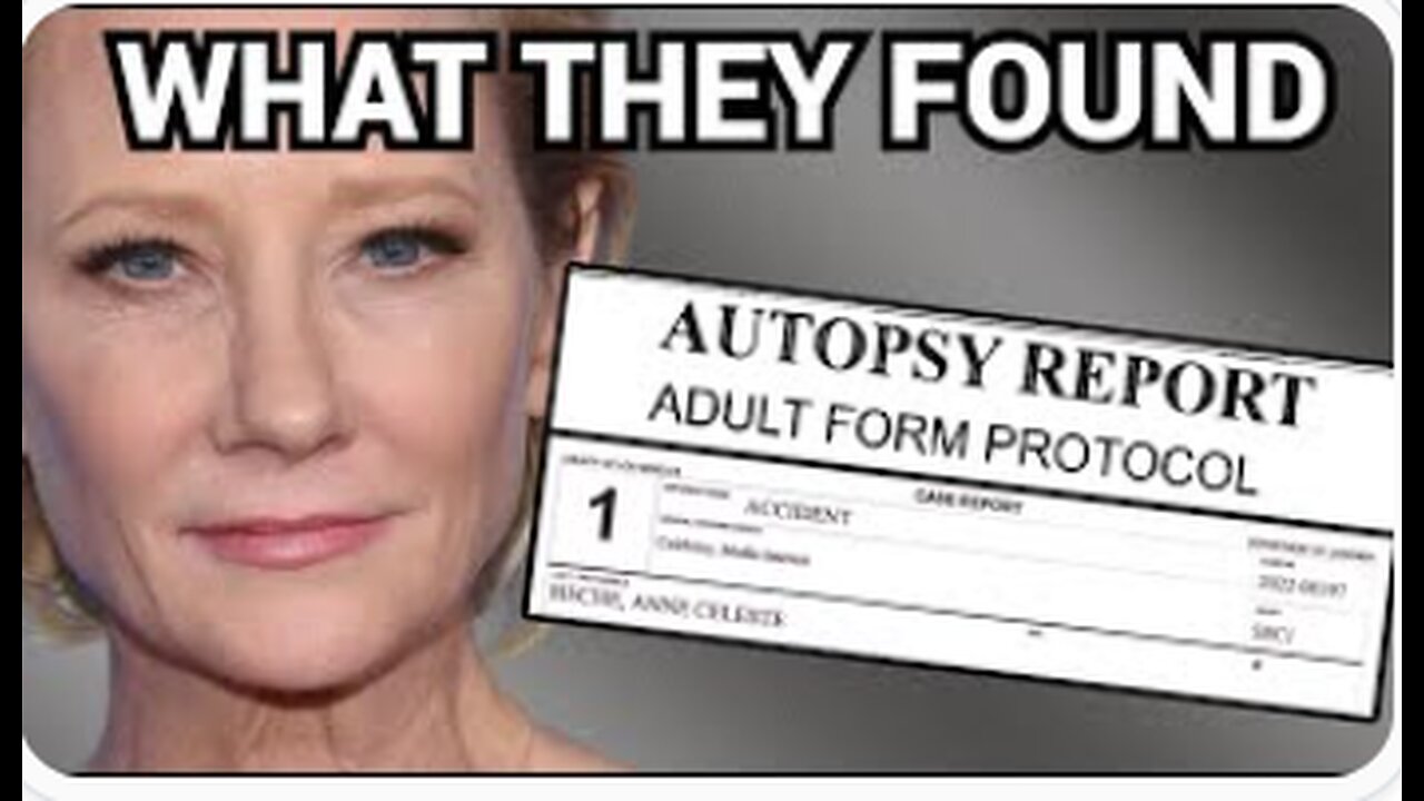 The REAL Story Behind Anne Heche's Fatal Crash