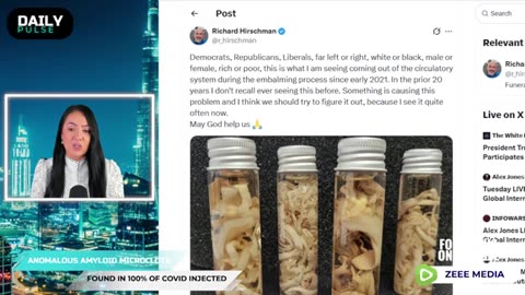 У 100 % вакцинированных COVID Образуются Микро-сгустки_ Daily Pulse Ep 146 Мария Зи